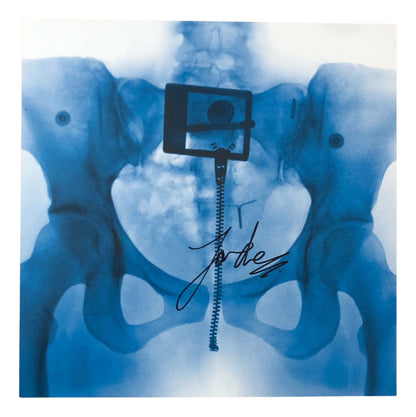 Lorde Virgin In X-ray Picture Hand LP Vinyl [ Autografiado ]