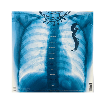 Lorde Virgin In X-ray Picture Hand LP Vinyl [ Autografiado ]